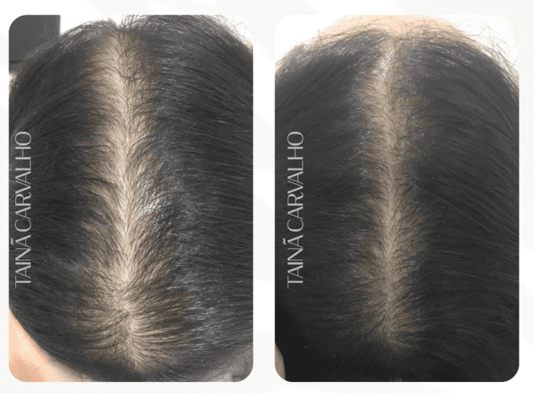 Modelo Antes X Depois (10)