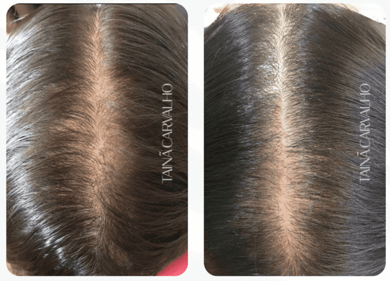 Modelo Antes X Depois (9)